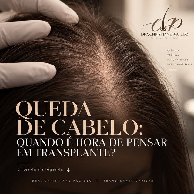 Queda de cabelo: quando é hora de pensar em transplante?

Quando a rarefação começa a ficar mais evi