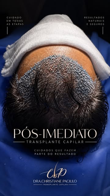 O transplante não termina quando o último folículo é implantado. ✨

O pós-imediato também exige cuid