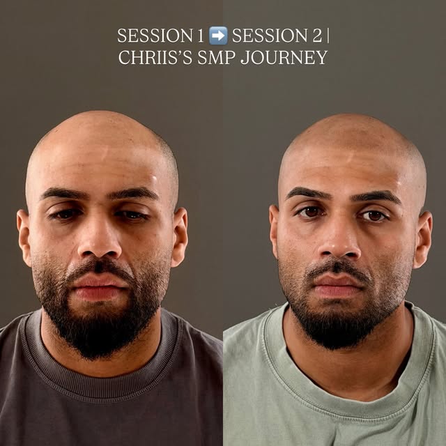 CHRIIS’S SMP JOURNEY

Another stage in Chriis’s transformation — and you can really start to see thi