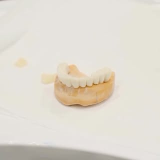 Dental treatment ♥️♥️

Our posts are for informational purposes only.
Medical procedures are carried