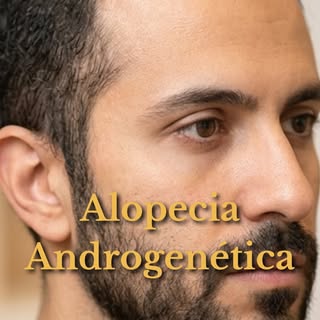 ¿Te han hablado de alopecia androgenética y todavía no tienes claro qué significa?
En este Reel te e