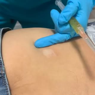 Winter Park Regenerative Medicine
Stem Cells : the fountain of youth
Stem Cells • PRP • Exosomes