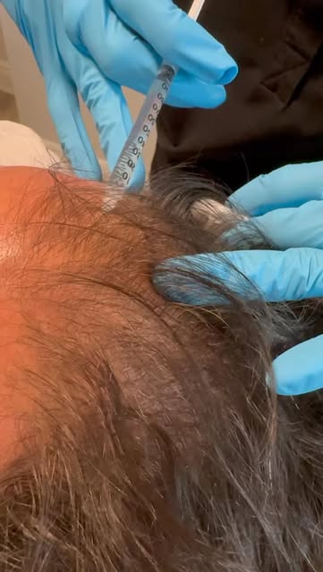 ✨ Stronger roots. Fuller-looking hair. Confidence restored. ✨

Struggling with thinning hair or hair