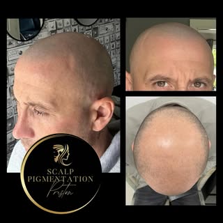 ‘Client Selfie’ 🙌 last session was two weeks ago creating a softer hairline ⬆️✅ Sign off session en