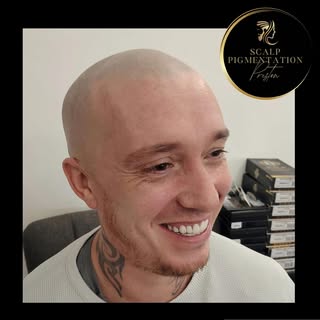 Subtle, natural ‘Scalp Micropigmentation SMP’ - the final session in a couple of weeks will give a s