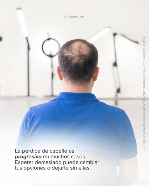 La caída de cabello no siempre se detiene por sí sola.

Si has comenzado a notar cambios, una valora