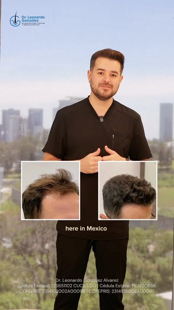 Thinking about a hair transplant but not sure where to start?

I’m Dr. Leonardo González, a physicia