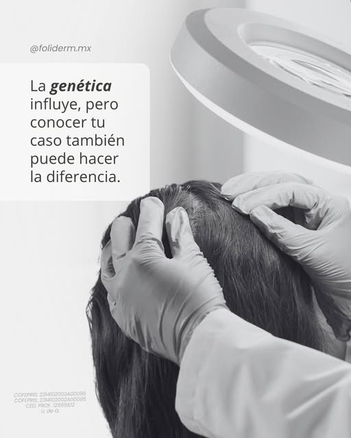 Si en tu familia hay antecedentes de pérdida de cabello, es normal preguntarte si también te pasará 