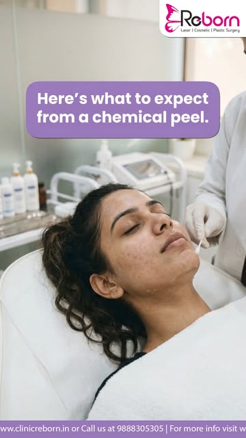 Pigmentation can be stubborn, but the right skin treatment can make a difference. ✨

Chemical peels 