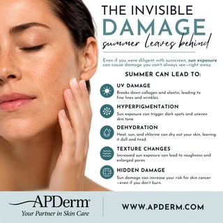The effects of summer on your skin aren't always visible right away. 

Even if you've been diligent 