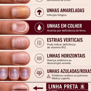 Suas unhas também podem dar sinais de que algo merece atenção. 💅🏼🔎

Alterações na cor, textura, f