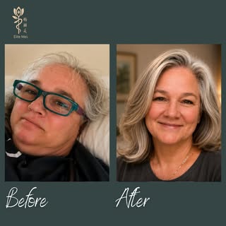 Women can experience thinning hair, receding hairlines, or areas of hair loss too, and a hair transp