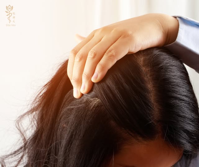 A higher hairline can change the way your entire face is framed. For some women, creating a softer, 
