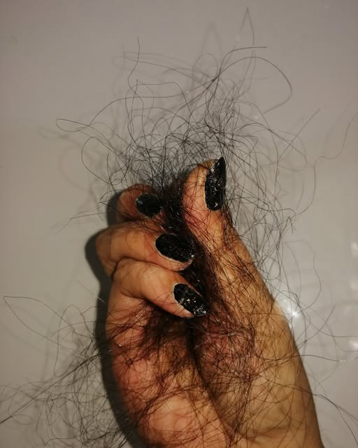Before you treat hair loss, find the cause. Hair thinning can happen for many different reasons. Gen