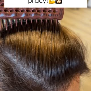 Jestem dumna z mojej Pacjentki!👏😍 Gratuluję wytrwałości w stosowaniu pielęgnacji domowej oraz supl