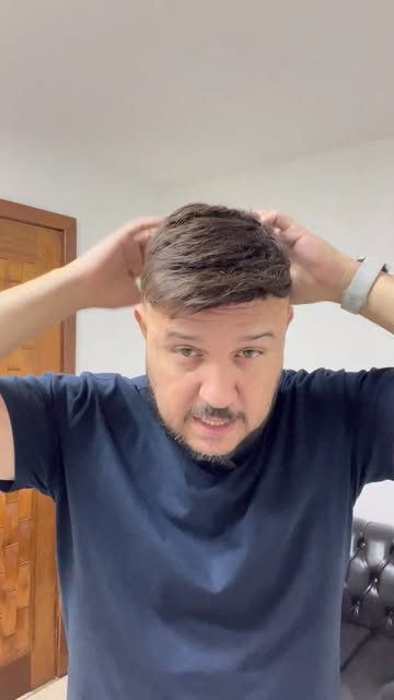 “Prótese capilar: você pode dormir com ela ou tirar para dormir. E hoje eu vou te ensinar a pentear 