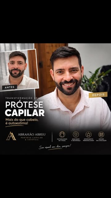 Transformações com a prótese capilar 
-
-
-
#prótesecapilar #baixadafluminense #novaiguaçurj #riodej