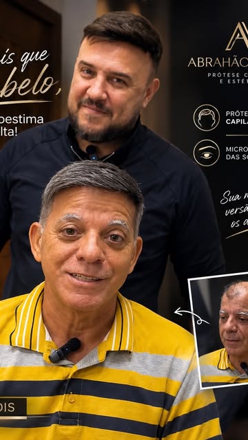 Transformação com a prótese capilar, venha viver essa experiência, solução indolor para a calvície, 