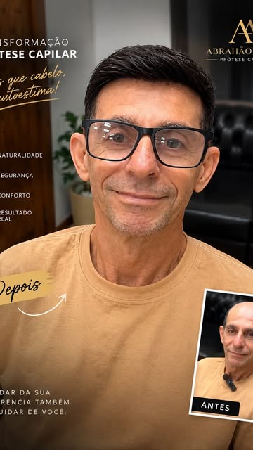 Realizar o sonho de alguém quer se sentir melhor é minha satisfação 
-
-
-
#prótesecapilar #baixadaf