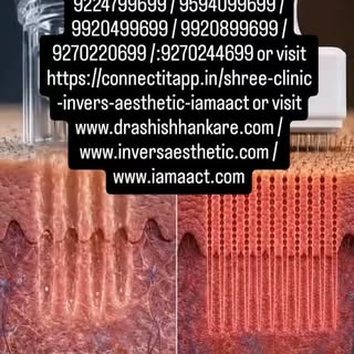 Collagen Induction Therapy -  Acne /Acne Scar /  Skin Rejuventation / Tightening / Lifting - To know