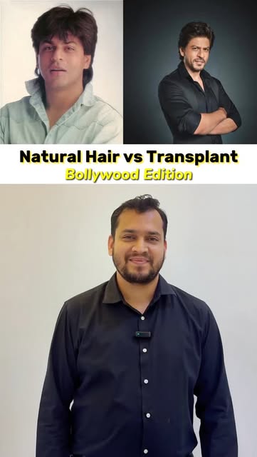 Natural Vs Hair Transplant Bollywood Edition with Dr. Akshay Bora

📍2nd Floor, Vidhya Plaza, ATM Ch
