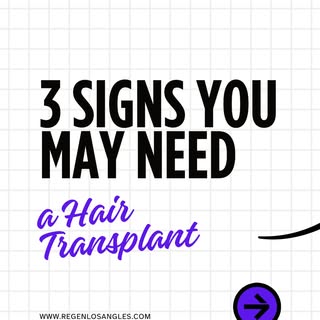 📞 Call (213) 403 0455 today to schedule your free consultation!

#HairTransplant #HairRestoration #