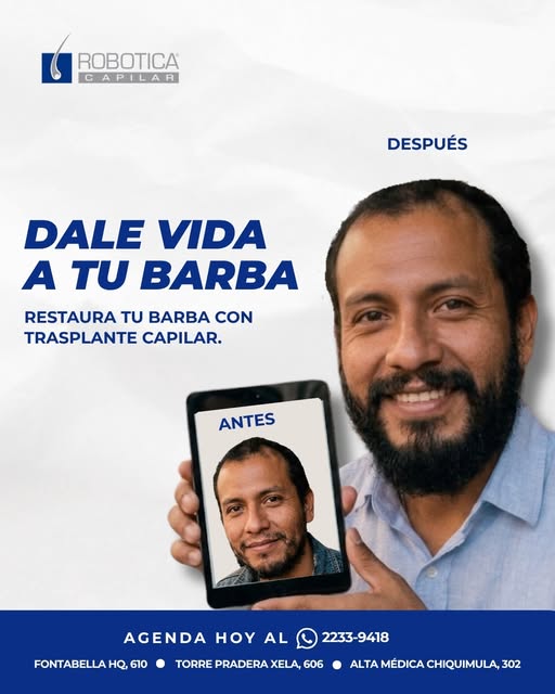¿Cansado de esa barba irregular o incompleta? 🤔 Dale un giro total a tu look y recupera tu confianz