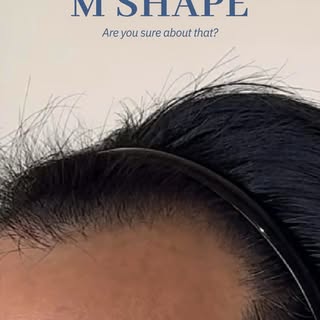 “There’s no way you can fix my M-shaped hairline.” You sure about that?

Sometimes, all it takes is 