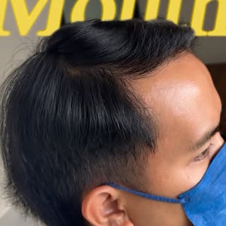 This is your sign to book that hair transplant appointment. 👀

Ready to begin your hair restoration