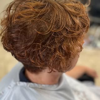 Treating your thyroid doesn’t automatically restore your hair.
​Medication balances your hormones, b