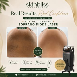✨ Real Results. Real Confidence. ✨
Say goodbye to unwanted facial hair and hello to smooth, flawless
