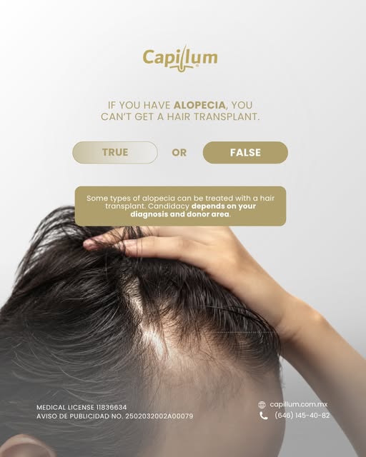 Having alopecia does not automatically rule out a hair transplant.

The type of hair loss, its progr