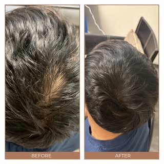 When looking at these results, notice how the hair doesn't just appear fuller—the individual strands