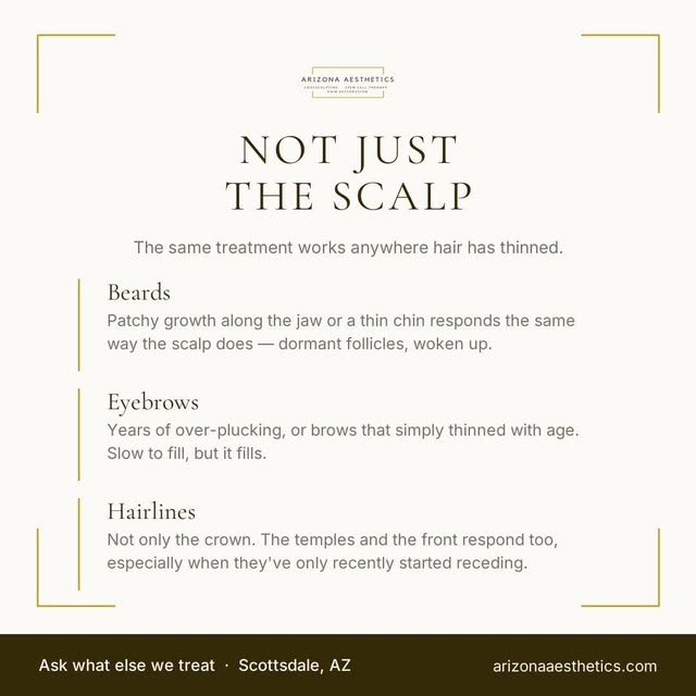 The same treatment works anywhere hair has thinned.
Beards: patchy growth along the jaw or a thin ch