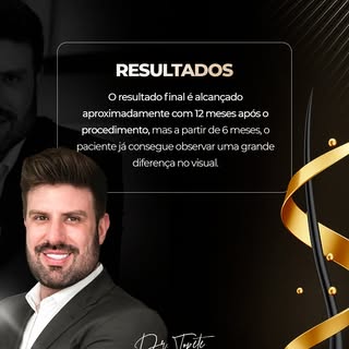 A paciência é uma parte essencial do processo de transplante capilar, e entender a linha do tempo do
