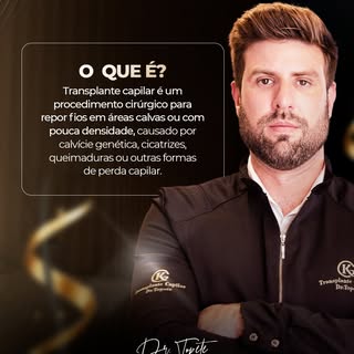 O transplante capilar é um procedimento cirúrgico moderno focado na restauração da densidade capilar