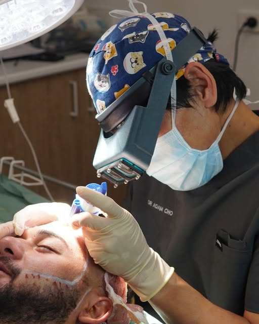 Implantation is where the plan becomes real. Using a multi-implanter, each graft is set into the sca