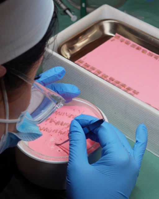 A lot of the work happens before a graft is ever placed.

Each follicular unit is carefully handled,