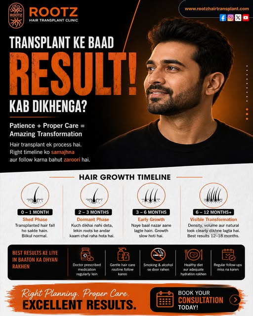 Hair Transplant Ke Baad Hair Growth Ki Real Journey Ab Shuru Hoti Hai! ✨

Har Stage Ko Samjhein Aur 