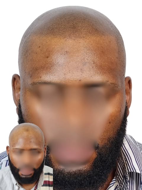 Le but de ma technique de l’ultra-réalisme en micropigmentation c’est de recréer l’apparence d’un cr