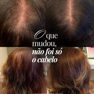 Você já percebeu que, quando o cabelo começa a dar sinais, a maioria das pessoas corre para trocar d