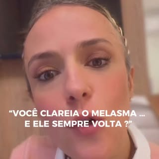 Melasma dérmico x epidérmico: por que alguns casos são mais difíceis de tratar?

O melasma não é tod