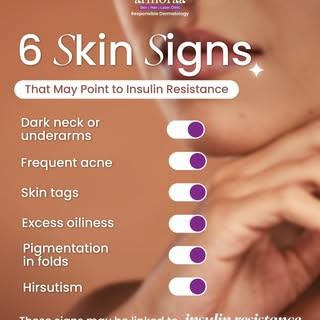 Your skin may be revealing more than you think. Could these signs point to insulin resistance?

#arm
