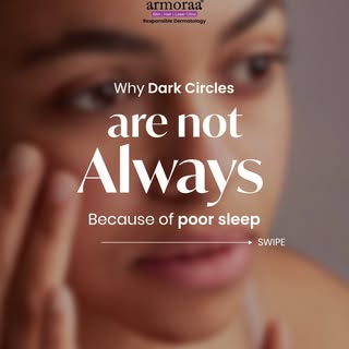 Still blaming your dark circles on late nights? There could be more happening under the surface.

#a