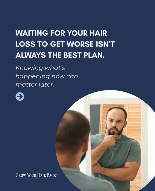 You don’t have to wait until your hair loss feels “bad enough” to start asking questions.

In fact, 