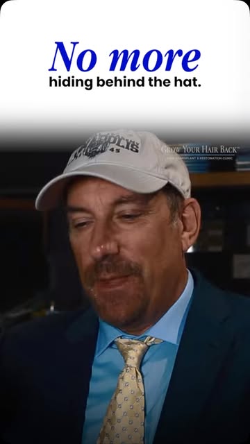 The hat shouldn’t have to be part of the plan.

For a lot of people, it becomes the easy way to stop