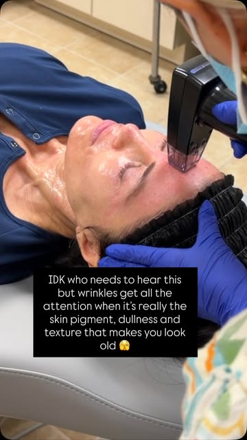 Hot take: Your wrinkles probably aren’t what’s making you look old. 👀

It’s the pigment. The dullne