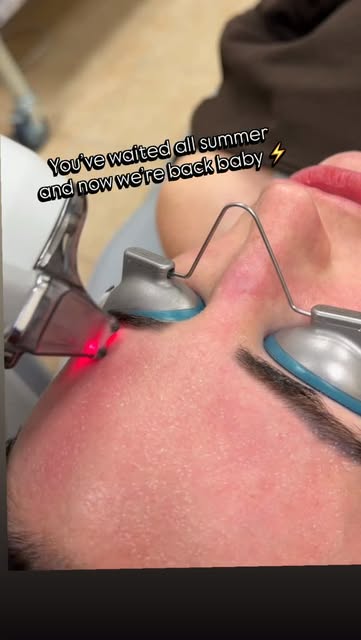 YOU WAITED ALL SUMMER… NOW IT’S TIME. 🔥

Laser season is BACK—and my schedule is filling FAST.

If 