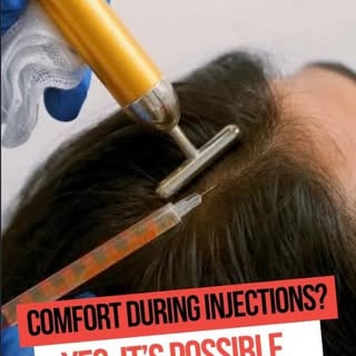Our doctors use gentle vibratory stimulation during GFC/PRP to help reduce the perception of needle 