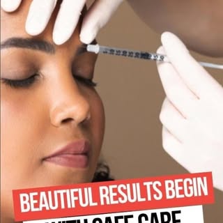 At Meraki Aesthetics, Botox is performed by qualified medical professionals with careful assessment,